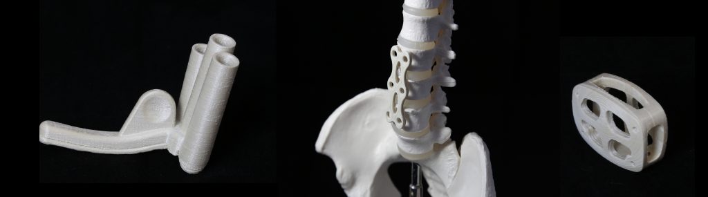 First concept models for 3D printed medical devices from LCP materials. Photo via Nematx.