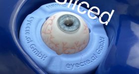 Eyecre的3D打印眼睛模型与切片的标志。