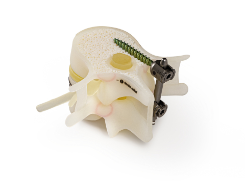 J750数字解剖打印机可以生成模拟骨骼、血管系统和器官组织的生物力学特性的模型。通过Stratasys公司照片。