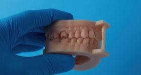 完全组装的牙科模型3D打印在模型树脂中。照片通过Formlabs。