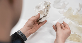 A 3D printed jaw model and bioresorbable implant.