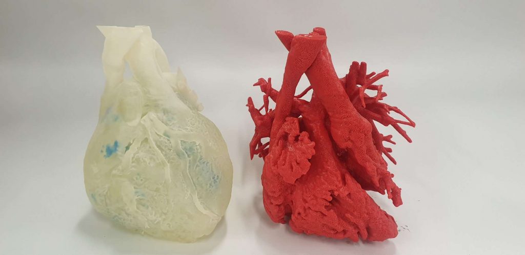 3D Lifeprints技术已被广泛应用于医疗领域，包括模拟手术的软打印模型（如图所示）。照片通过3D生活打印。