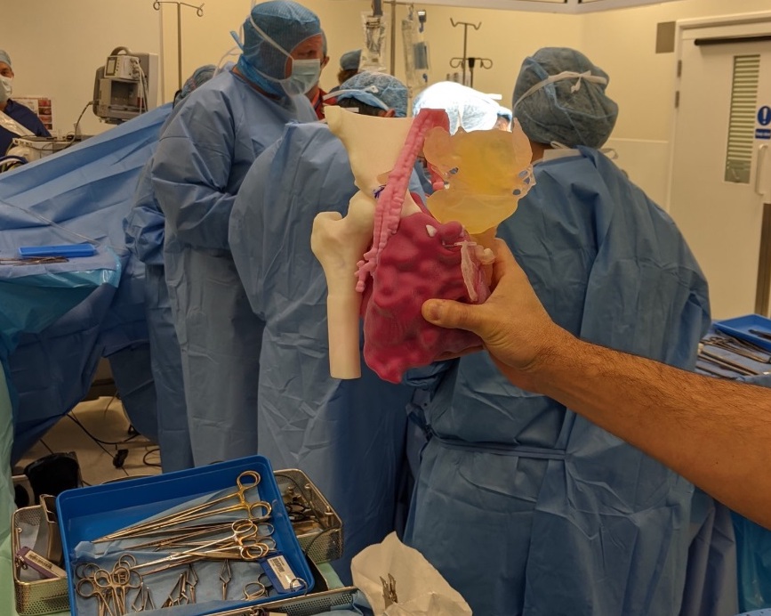 一位外科医生拿着一个3D生命打印3D打印的心脏模型。