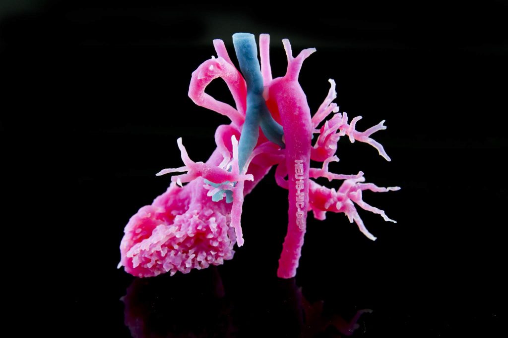 物化3D打印，患者特定的解剖模型，帮助医疗专业人员计划手术和更有效地与患者沟通。