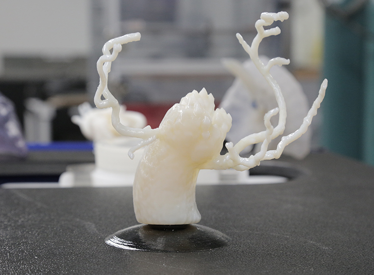 3D打印的心脏阀。通过GE Healthcare的照片