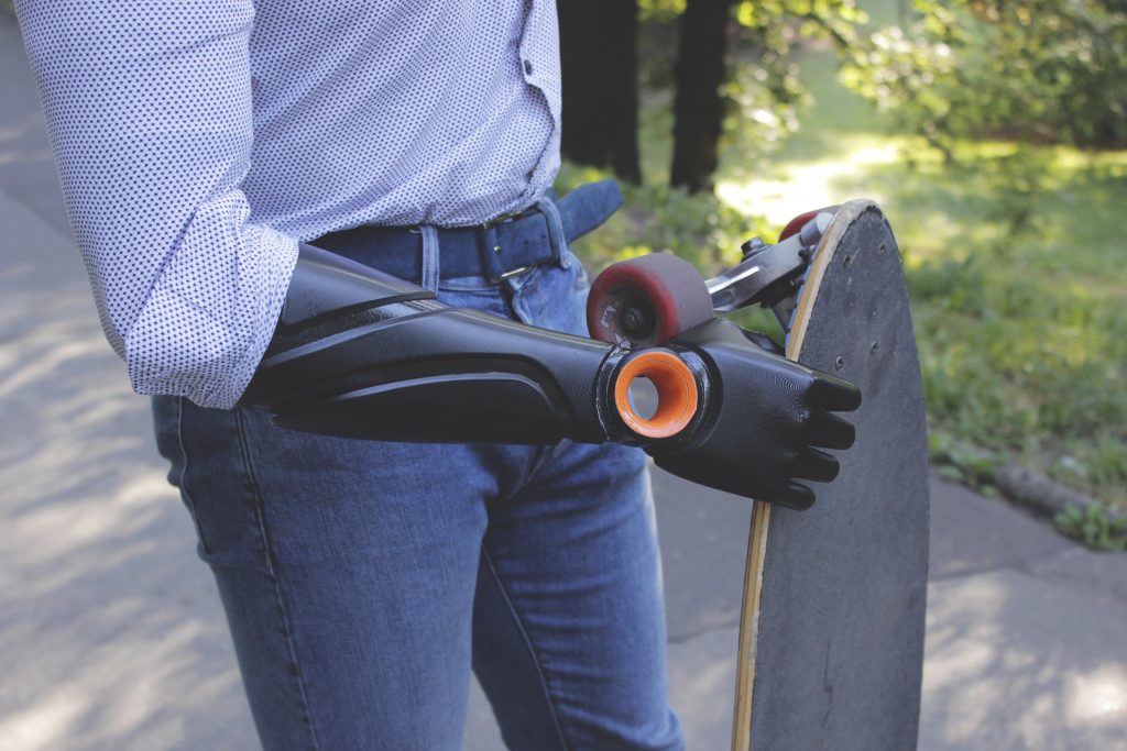 Piotr Sajdak holds a skateboard with his prosthetic arm. Photo via Glaze Prosthetics.