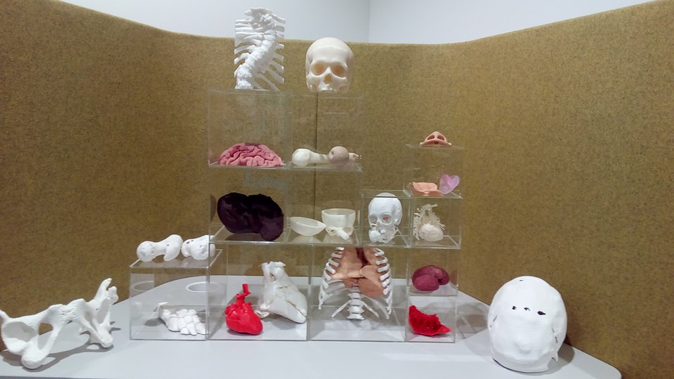 3D LifePrints range of 3D printed medical models. Photos via 3D LifePrints