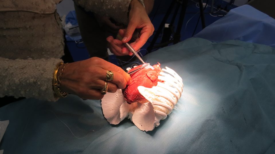 Test operation on a 3D printed heart model. Photo via 3D LifePrints