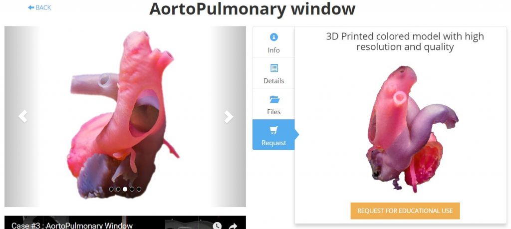 要一个3D打印心脏模型的报价。图像通过3D生活。