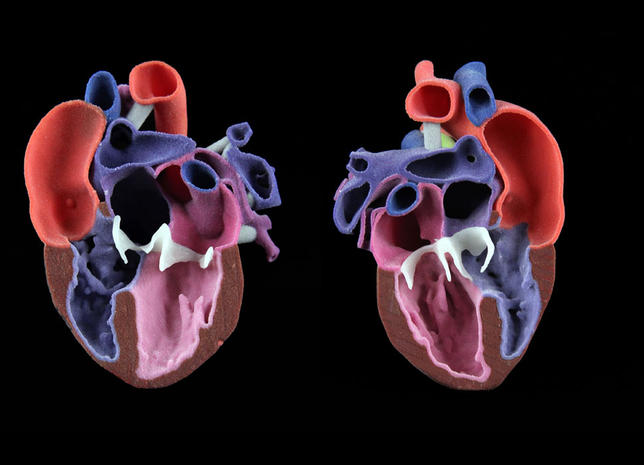 CJP小儿心脏模型照片通过3D系统。