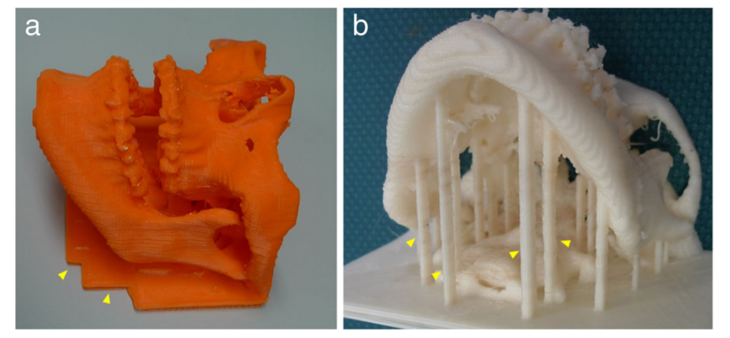3D打印牙科模型，支持结构，防止变形。照片由施普林格国际出版