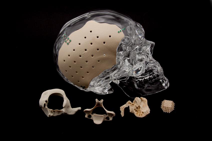 Osteofab 3D打印Pekk植入物。通过牛津表演材料照片。