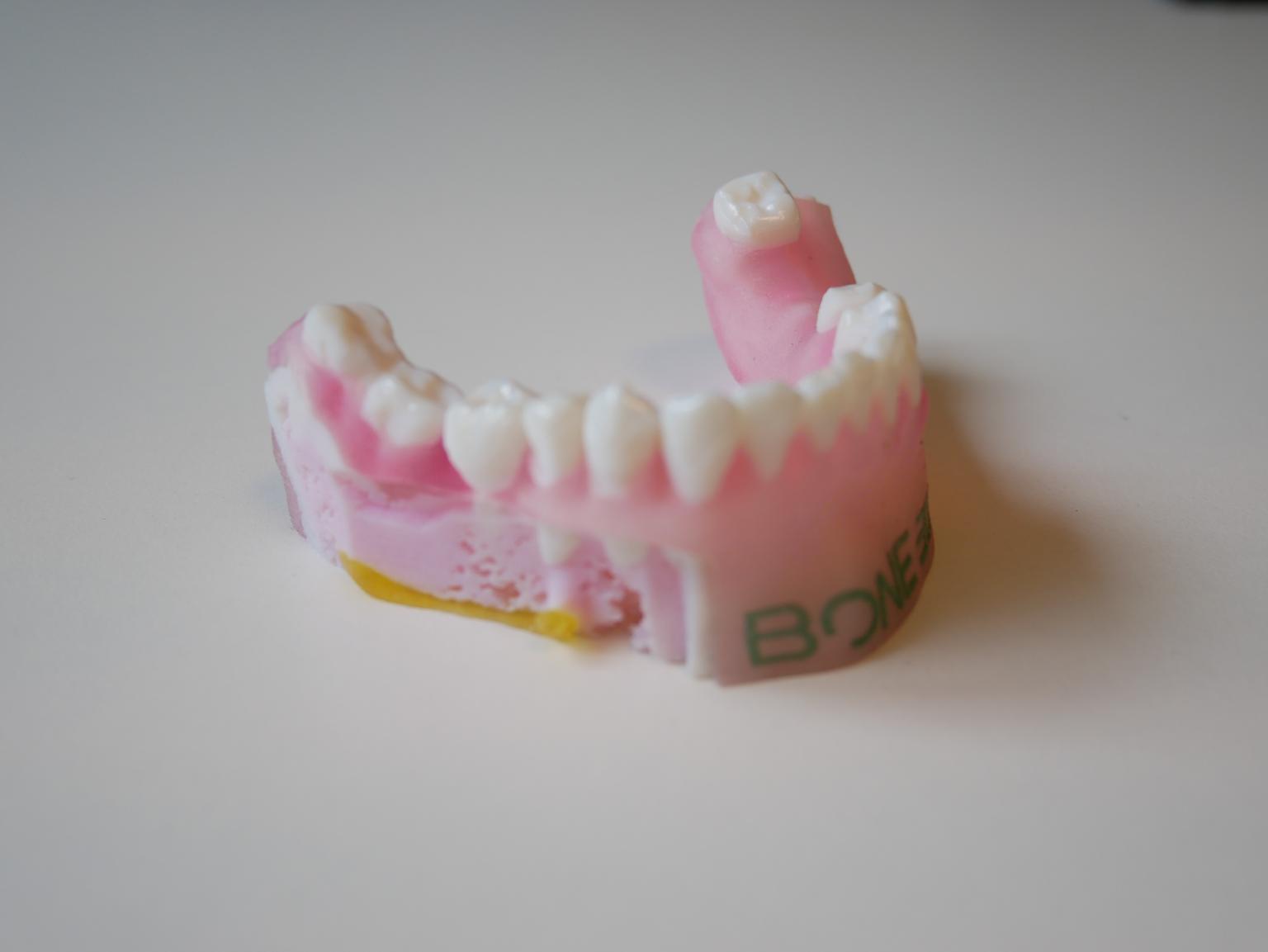 A 3D printed orthodontic model produced on the Stratasys J750. Photo via Bone 3D.