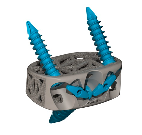 特色图显示4Web Medical的3D印刷前脊柱植入器装置。图片通过4WEB医疗。