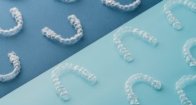 一批Prodways 3D打印牙科对准器。