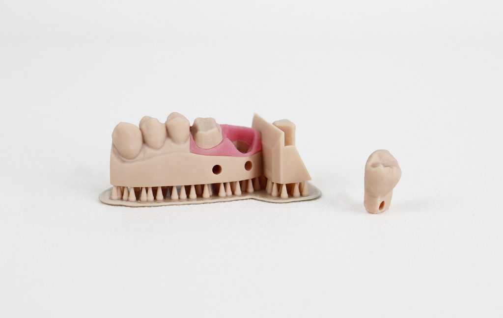 使用Liqcreate的牙科型Pro米色材料打印的部分型号3D。