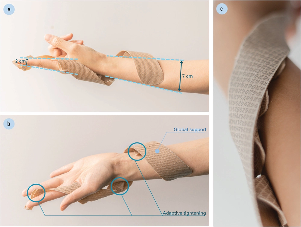 该腕夹板能够自适应紧固佩戴者的手腕。图片来自弗莱堡大学。