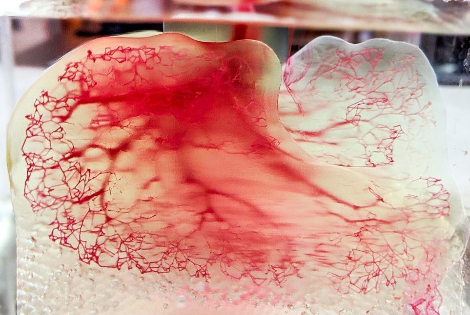 使用3D系统的打印到灌注过程创建的人体血管模型。图片来自United Therapeutics。