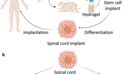 这stages of Matricelf's 3D bioprinted spinal cord process. Image via Matricelf.