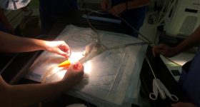 3D打印的主动脉模型在手术室的真实条件下使用。通过3Deus Dynamics的照片。