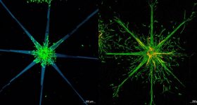 研究人员利用其多光子光刻过程，创建了星形图案（左），细胞可以生长（右）。图片通过Tu Wien。