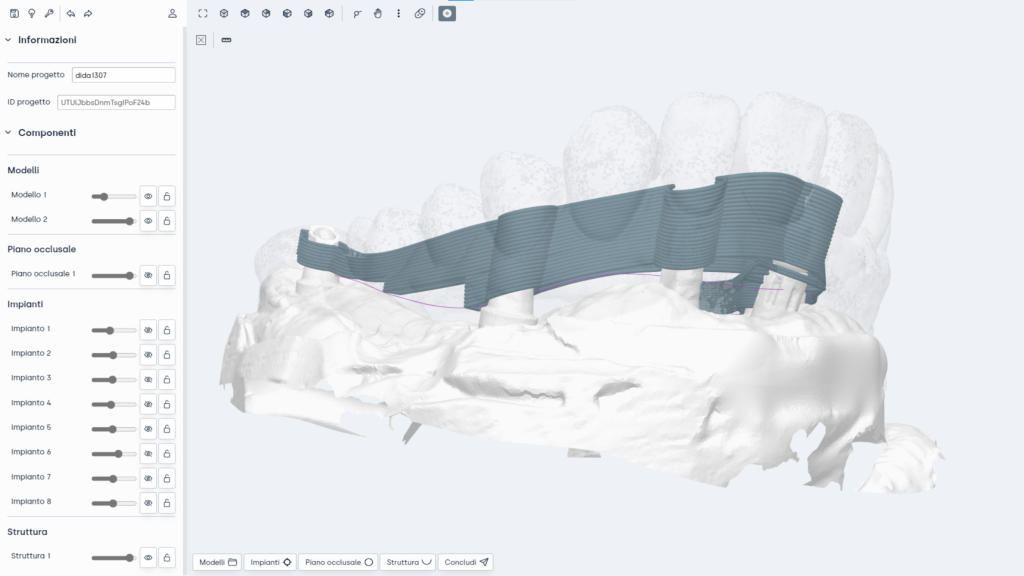 高纤维3D打印牙科支架的CAD模型。